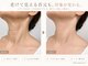 【たるみケア・シミケア・毛穴】エイジングケアAreum(アルム)戸塚の写真