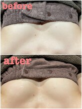 グロー(GLOW)/バストアップケア