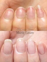 マリーロール 淀屋橋本店(Marie Laure)/自爪育成/深爪矯正/ネイルケア