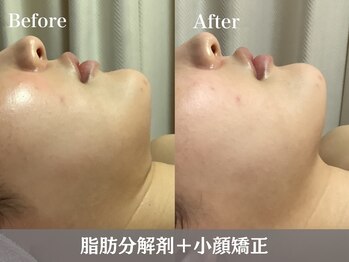 RHB東戸塚/小顔エステはRHB東戸塚