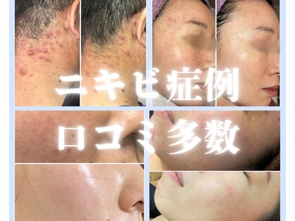 ディンプル(Dimple)の写真