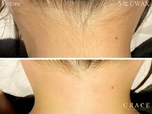 グレイス 久留米店(GRACE)/女性に人気のうなじワックス♪