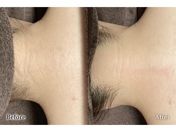 アネル 豊見城(anel)/