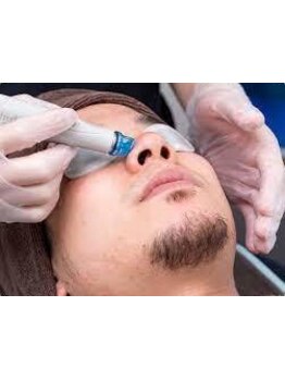 メンズフェイシャル