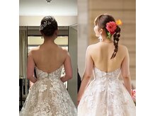 すみれ鍼灸整骨院/神戸　ブライダル美容整体