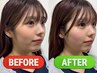 【PR用】小顔矯正コルギ/小顔矯正コルギ/小顔矯正コルギ/小顔矯正コルギ/
