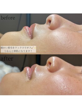 コモレビ(komorebi)の写真/【40代からの肌管理】透明感フェイスワックスでベタ塗りファンデ卒業