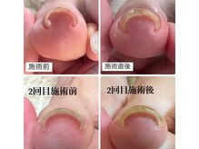 ネイルドットイチマルハチ(Nail.108)