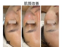 グロウ バイ フェイシャルデザイン アンド アイ(GROW)の雰囲気（お悩み別で施術をご提案♪実績はフォトギャラリー＆ブログにて★）