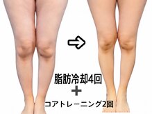 脂肪冷却LABOの雰囲気(3回以上続けることで効果が出てきます^_^)