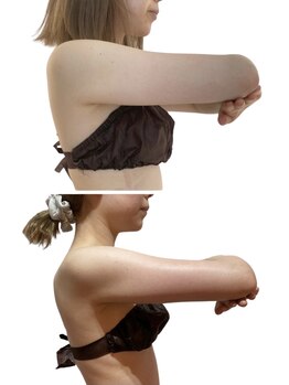 痩せラボ/スッキリ二の腕【ブライダル】