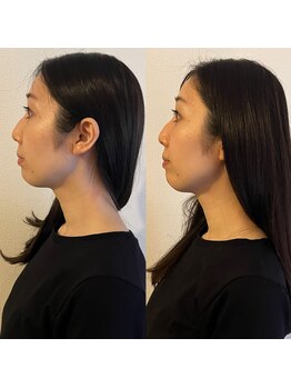 ラ アクサル(la.akthar)/小顔 全身 骨格 頭蓋骨 整体