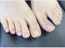 足の爪の長さと形を整えると、爪のトラブルの予防になります！