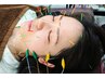 【肌質向上美容鍼】 小顔よりもち肌重視の方はこちら　¥11,400→¥7,980