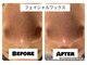 プラチナ ヒーリング(PLATINUM HEALING.)の写真