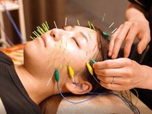 エンカフェサロン(en-cafe salon)/鍼灸◆