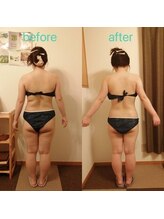 アンジュ/ハイパーナイフ全身贅沢コース