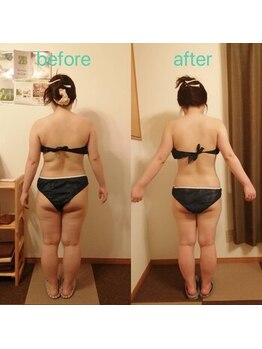 アンジュ/ハイパーナイフ全身贅沢コース