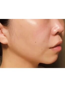 ハリツヤをUPしたい