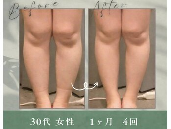 イットセルフ(itself)/よもぎ蒸しでむくみスッキリ！