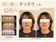 ルフレ(Reflet)の写真