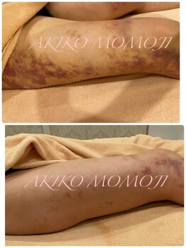 エムグレイス(m-grace's)/美容整形　術後ケア