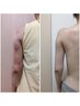 【術後ケア専用】人気急上昇！少しでも早く改善したい方へ　インディバ120分