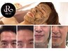 【メンズ限定★敏感肌にも】REVI陶肌ハーブピーリング＋サロン特典