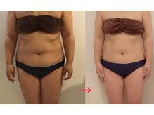 エステティックサロン エポック(epoque)/ビフォー・アフター