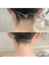 イクスト 吉祥寺(IKUST)/【フェイシャルワックス/脱毛】