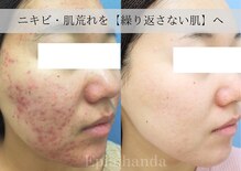 エピア 半田店(Epia)