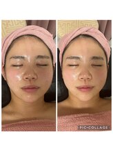 BBC 田園調布/小顔コルギの効果！