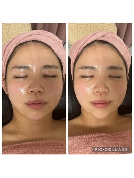 BBC 田園調布/小顔コルギの効果！