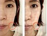 ＼新規／30分で小顔に♪食いしばり・表情・眼精・脳ほぐし　¥6600→¥3300