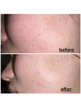 ミニョン(mignon)/乾燥しているこの季節に！