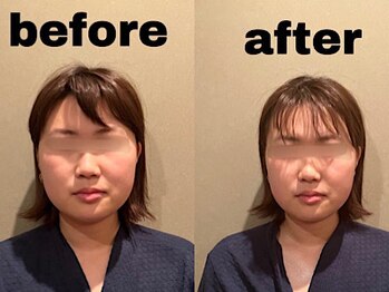 ラースパ アザブ(La SPA azabu)/一回の施術で効果を実感！