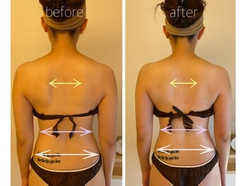 パル コルギサロン(Pal. Korugi salon)/コルギビフォーアフター