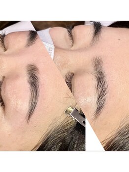 ヴィプラス(Vi+)/