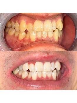 ライトビューティー 池袋店(LightBeauty)/症例写真