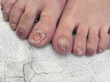 イト 藤崎店(ito)/お洒落フットネイル☆