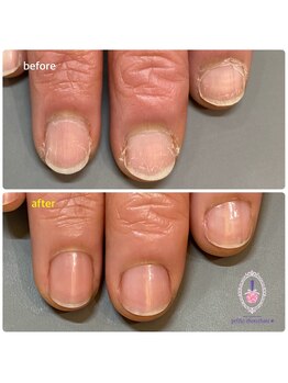 プティ シュシュ(Petite chouchou)/ネイルケア初めての方も歓迎♪