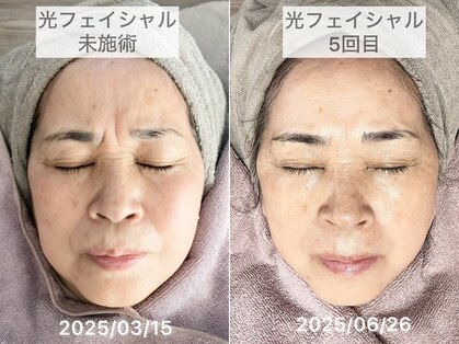 ブルーム(Bloom.)の写真