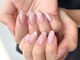 ブレスネイル(brace Nail)の写真