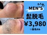 【メンズ脱毛】超人気！！迷ったらコレ！コラーゲン配合ヒゲ脱毛体験☆￥3980