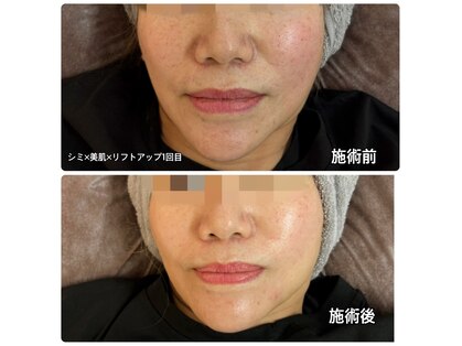 ベルミノン(BelleMignon)の写真