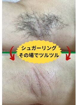 ディスイズミー シュガーリング(This is me Sugaring)/【シュガー】半袖の季節おすすめ