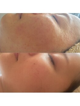 ナヴィータ アオバダイ(Navita AOBADAI)/エンビロン/2ヶ月集中コース