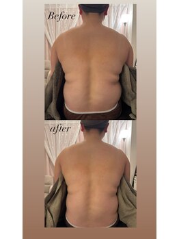 ジョワ(joie)/一回で背中の変化を実感