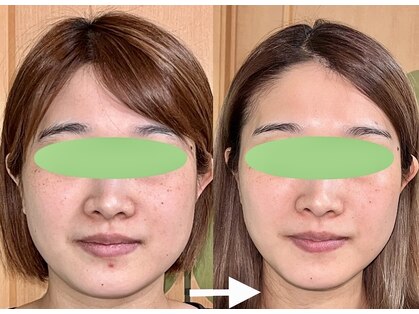 ふくふくの写真