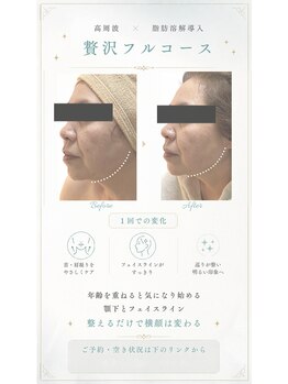 エフリア 大垣(F.lia)/フェイスライン、スッキリ★
